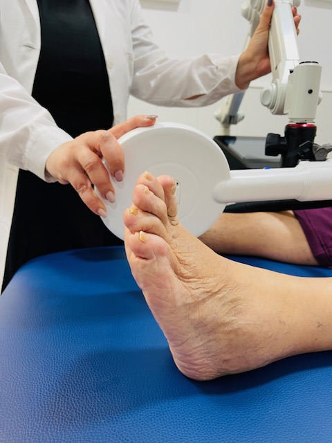 ¿En qué consiste el tratamiento CMP para mi pie?
