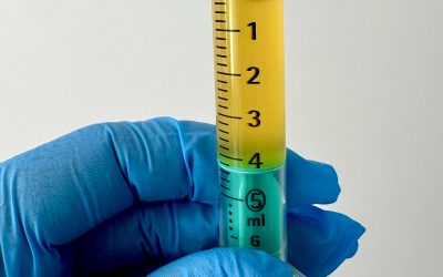 ¿Cuál es el mejor tratamiento para el dolor de talón?