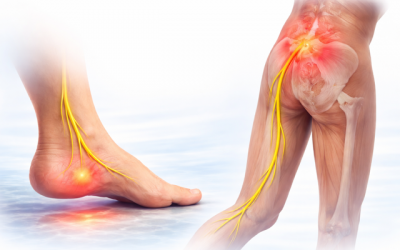 Conexión directa :Pie – dolor lumbar